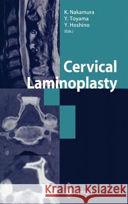 Cervical Laminoplasty Nakamura                                 Kozo Nakamura Yoshiaki Toyama 9784431703044 Springer