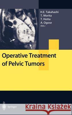 Operative Treatment of Pelvic Tumors Tetsuo Hotta Tetsuro Morita Hideaki Takahashi 9784431703303 Springer