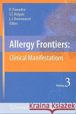 Allergy Frontiers:Clinical Manifestations Ruby Pawankar, Stephen T. Holgate, Lanny J. Rosenwasser 9784431883166 Springer Verlag, Japan