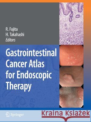 Gastrointestinal Cancer Atlas for Endoscopic Therapy Rikiya Fujita Hiroshi Takahashi 9784431998600