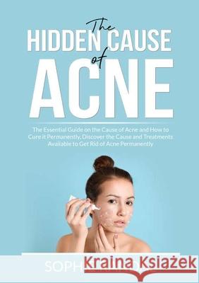 The Hidden Cause of Acne: The Essential Guide on the Cause of Acne and How to Cure it Permanently, Discover the Cause and Treatments Available t Sophie Randal 9786069837412