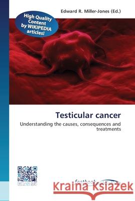 Testicular cancer Miller-Jones, Edward R. 9786130141622