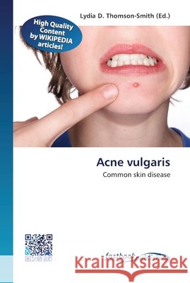 Acne vulgaris Lydia D Thomson-Smith 9786130142346 Fastbook Publishing