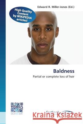 Baldness Edward R Miller-Jones 9786130142636 Fastbook Publishing