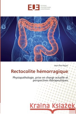 Rectocolite hémorragique Rajan-J 9786131582967
