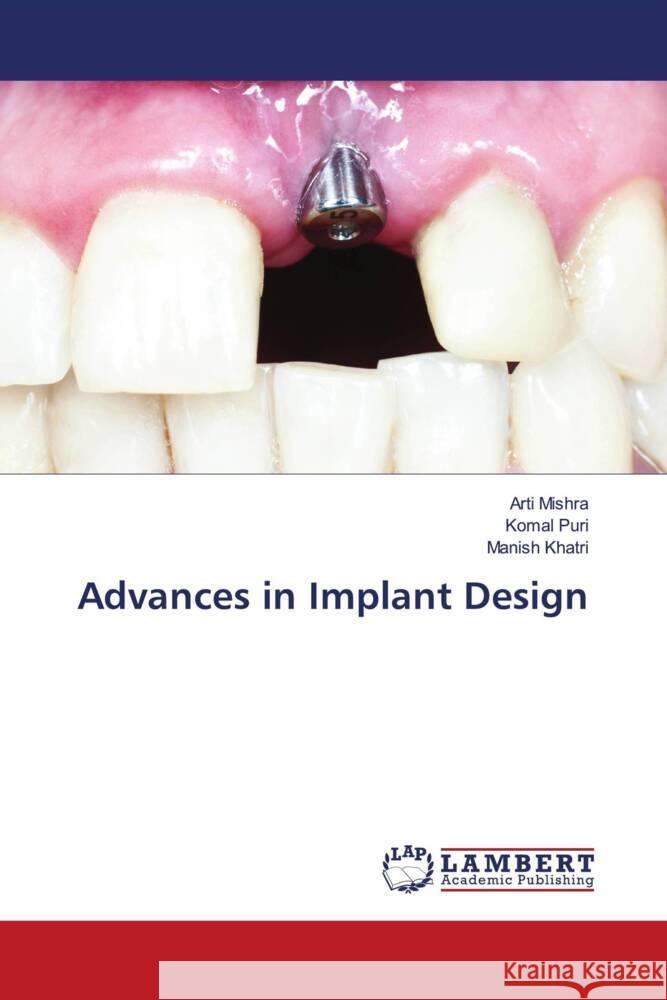 Advances in Implant Design Mishra, Arti, Puri, Komal, Khatri, Manish 9786133991217