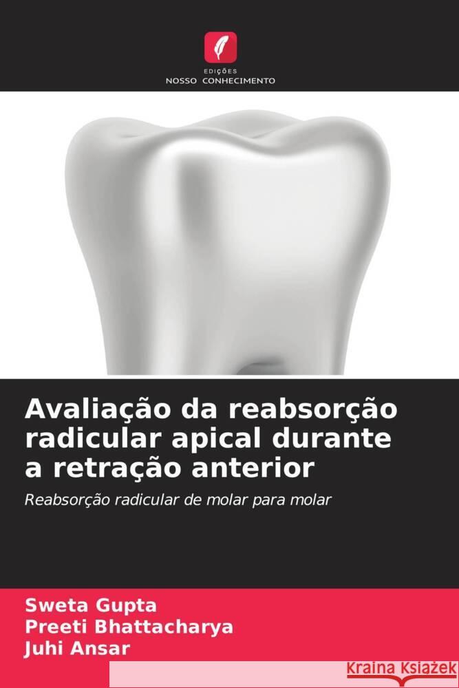 Avaliação da reabsorção radicular apical durante a retração anterior Gupta, Sweta, Bhattacharya, Preeti, Ansar, Juhi 9786134958844