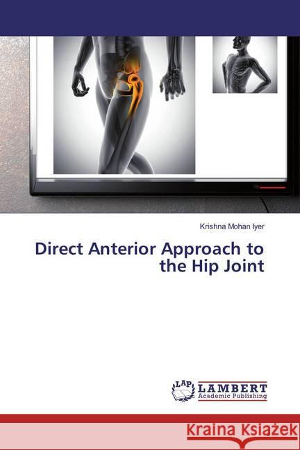 Direct Anterior Approach to the Hip Joint Iyer, Krishna Mohan 9786134976640