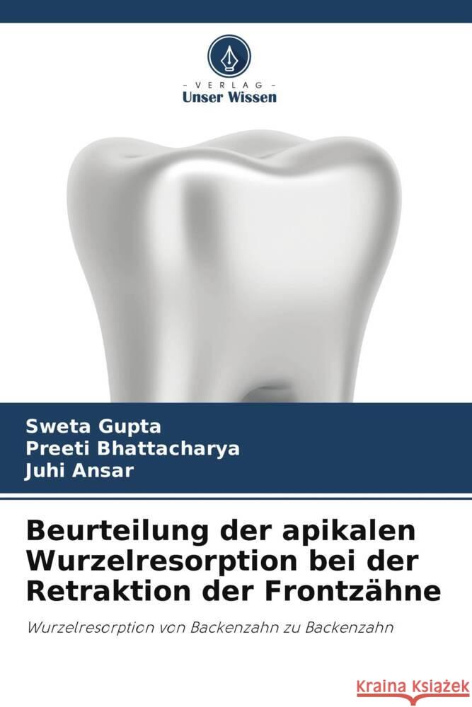 Beurteilung der apikalen Wurzelresorption bei der Retraktion der Frontzähne Gupta, Sweta, Bhattacharya, Preeti, Ansar, Juhi 9786134991254