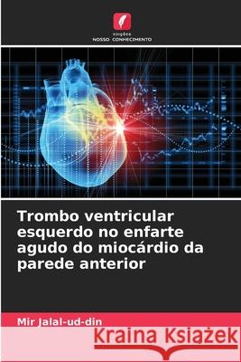 Trombo ventricular esquerdo no enfarte agudo do miocárdio da parede anterior Jalal-ud-din, Mir 9786136286266