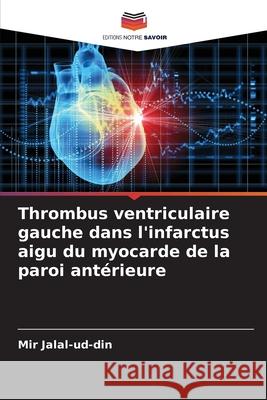 Thrombus ventriculaire gauche dans l'infarctus aigu du myocarde de la paroi antérieure Jalal-ud-din, Mir 9786136286815