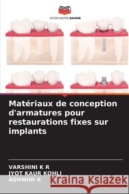 Matériaux de conception d'armatures pour restaurations fixes sur implants K R, VARSHINI, Kohli, Jyot Kaur, K, ASHWINI 9786136348384 Editions Notre Savoir
