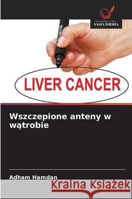 Wszczepione anteny w watrobie Hamdan, Adham 9786136363356