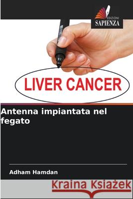 Antenna impiantata nel fegato Hamdan, Adham 9786136432083