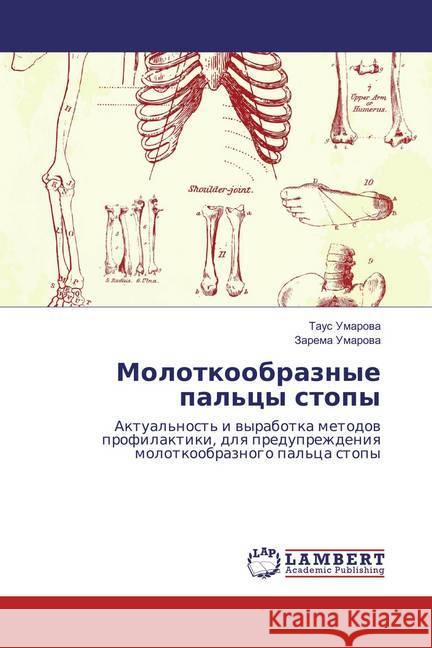 Molotkoobraznye pal'cy stopy : Aktual'nost' i vyrabotka metodov profilaktiki, dlya preduprezhdeniya molotkoobraznogo pal'ca stopy Umarova, Taus; Umarova, Zarema 9786137039151 LAP Lambert Academic Publishing