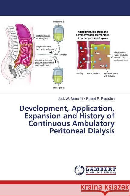 Development, Application, Expansion and History of Continuous Ambulatory Peritoneal Dialysis Moncrief, Jack W.; Popovich, Robert P. 9786137178942