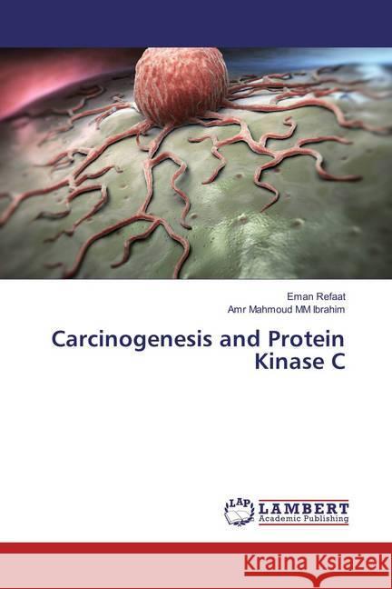 Carcinogenesis and Protein Kinase C Refaat, Eman; Ibrahim, Amr Mahmoud M. M. 9786137347614 LAP Lambert Academic Publishing