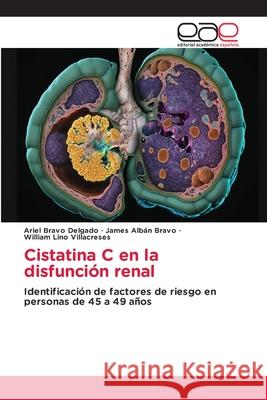 Cistatina C en la disfunción renal Bravo Delgado, Ariel, Albán Bravo, James, Lino Villacreses, William 9786137360583