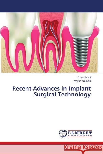 Recent Advances in Implant Surgical Technology Bhati, Chavi; Kaushik, Mayur 9786137432693 LAP Lambert Academic Publishing