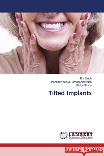 Tilted Implants Singh, Era; Ramasanjeevaiah, Jnanadev Kanva; Shetty, Shilpa 9786138329435 LAP Lambert Academic Publishing