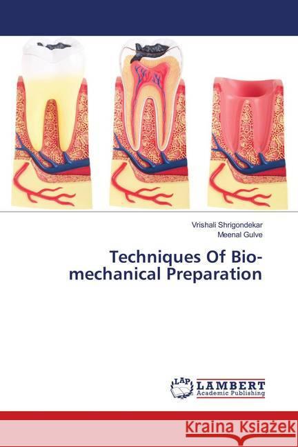 Techniques Of Bio-mechanical Preparation Shrigondekar, Vrishali; Gulve, Meenal 9786138339694