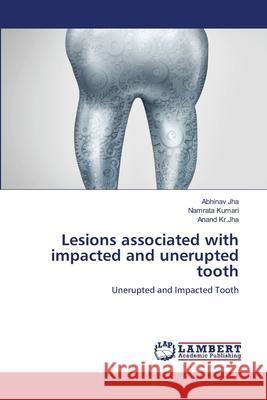 Lesions associated with impacted and unerupted tooth Jha, Abhinav 9786138340607 LAP Lambert Academic Publishing