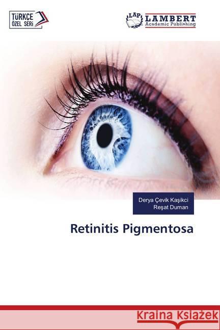 Retinitis Pigmentosa Çevik Kasikci, Derya; Duman, Resat 9786138385851