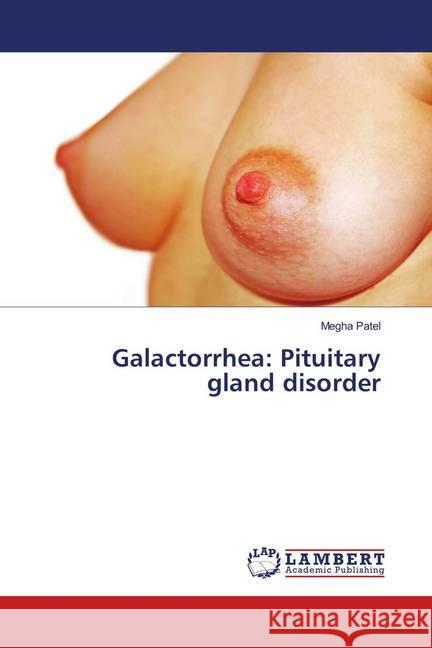 Galactorrhea: Pituitary gland disorder Patel, Megha 9786138389095 LAP Lambert Academic Publishing