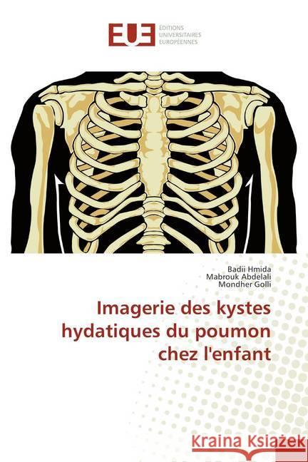 Imagerie des kystes hydatiques du poumon chez l'enfant Hmida, Badii; Abdelali, Mabrouk; Golli, Mondher 9786138403890 Éditions universitaires européennes