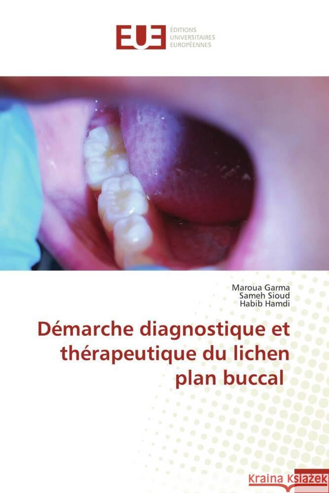 Démarche diagnostique et thérapeutique du lichen plan buccal Garma, Maroua, Sioud, Sameh, Hamdi, Habib 9786138425731