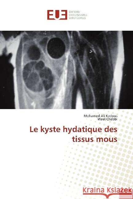 Le kyste hydatique des tissus mous Kedous, Mohamed Ali; Chebbi, Wael 9786138426141