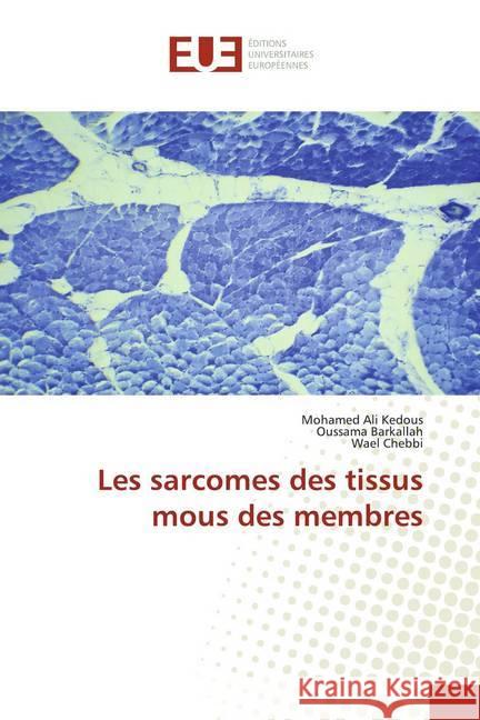 Les sarcomes des tissus mous des membres Kedous, Mohamed Ali; Barkallah, Oussama; Chebbi, Wael 9786138431848