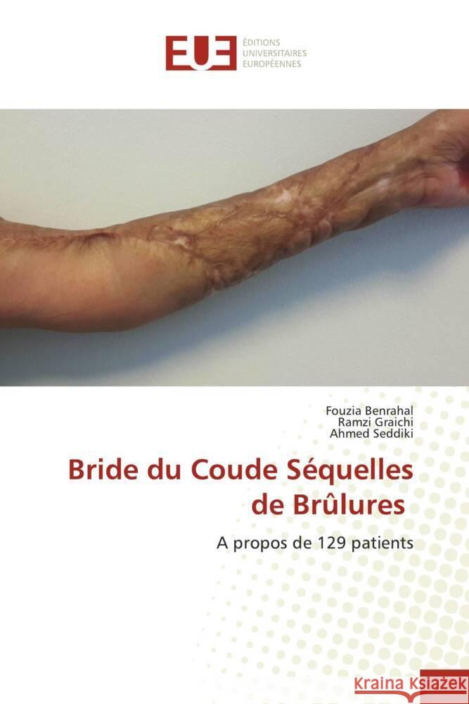 Bride du Coude Séquelles de Brûlures Benrahal, Fouzia, Graichi, Ramzi, Seddiki, Ahmed 9786138458135 Éditions universitaires européennes