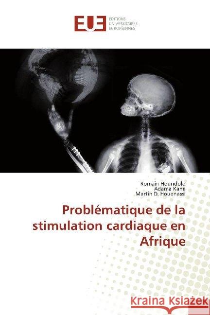 Problématique de la stimulation cardiaque en Afrique Houndolo, Romain; Kane, Adama; Houenassi, Martin D. 9786138460640