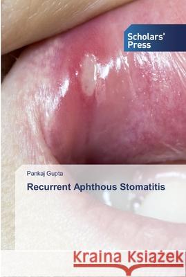 Recurrent Aphthous Stomatitis Gupta, Pankaj 9786138931904 Scholar's Press