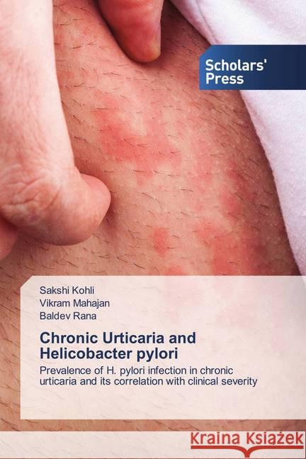 Chronic Urticaria and Helicobacter pylori Kohli, Sakshi, Mahajan, Vikram, Rana, Baldev 9786138940579 Scholar's Press