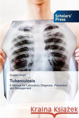Tuberculosis Gurjeet Singh 9786138942887