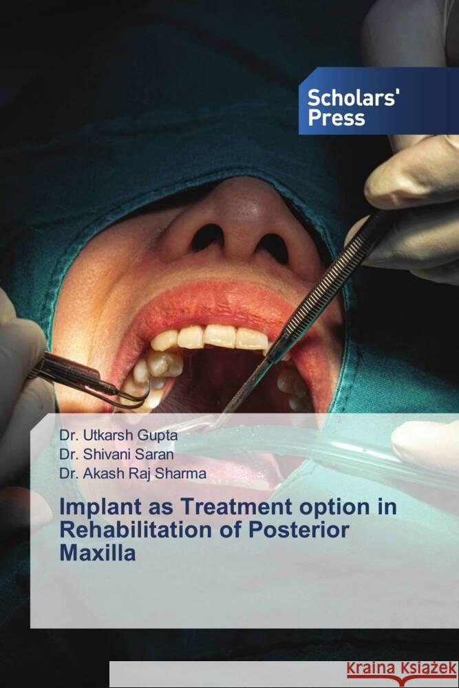 Implant as Treatment option in Rehabilitation of Posterior Maxilla Dr Utkarsh Gupta, Dr Shivani Saran, Dr Akash Raj Sharma 9786138947875