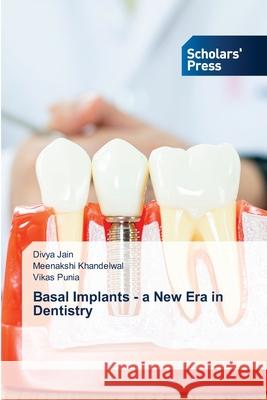 Basal Implants - a New Era in Dentistry Divya Jain Meenakshi Khandelwal Vikas Punia 9786138948353