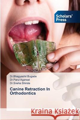 Canine Retraction In Orthodontics Dr Bhagyashri Bugade Dr Parul Agarwal Dr Sneha Shinde 9786138954231