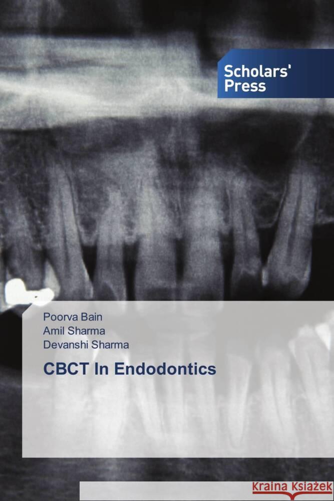 CBCT In Endodontics Bain, Poorva, Sharma, Amil, Sharma, Devanshi 9786138961321