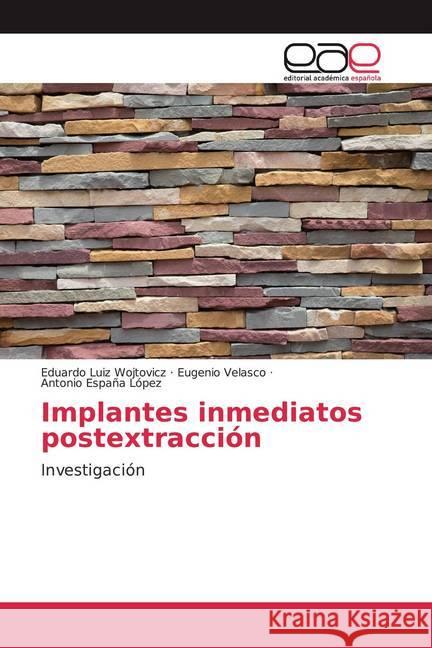 Implantes inmediatos postextracción : Investigación Wojtovicz, Eduardo Luiz; Velasco, Eugenio; España López, Antonio 9786139049516 Editorial Académica Española