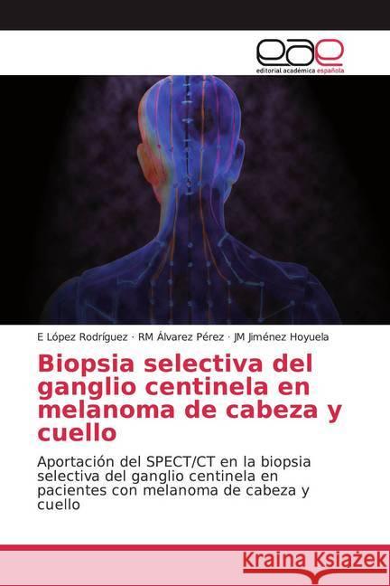 Biopsia selectiva del ganglio centinela en melanoma de cabeza y cuello : Aportación del SPECT/CT en la biopsia selectiva del ganglio centinela en pacientes con melanoma de cabeza y cuello López Rodríguez, E; Álvarez Pérez, RM; Hoyuela, JM Jiménez 9786139074815 Editorial Académica Española