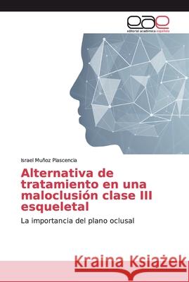 Alternativa de tratamiento en una maloclusión clase III esqueletal Muñoz Plascencia, Israel 9786139184507