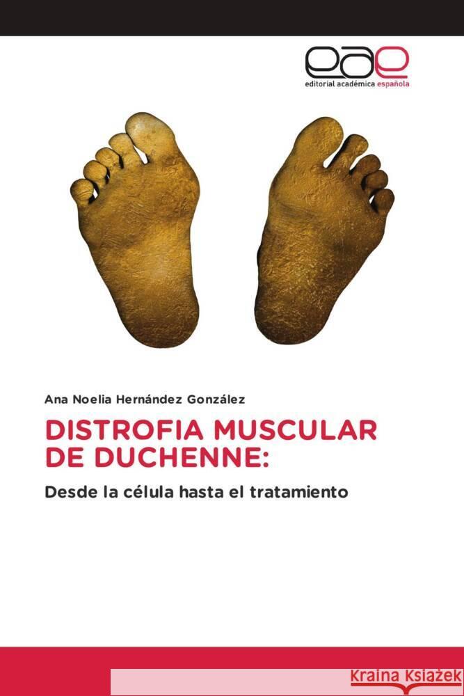 Distrofia Muscular de Duchenne Ana Noelia Hern?nde 9786139412433