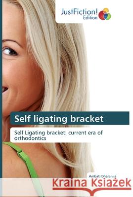 Self ligating bracket Dharanija, Ambati 9786139425808 Edizioni Sant' Antonio