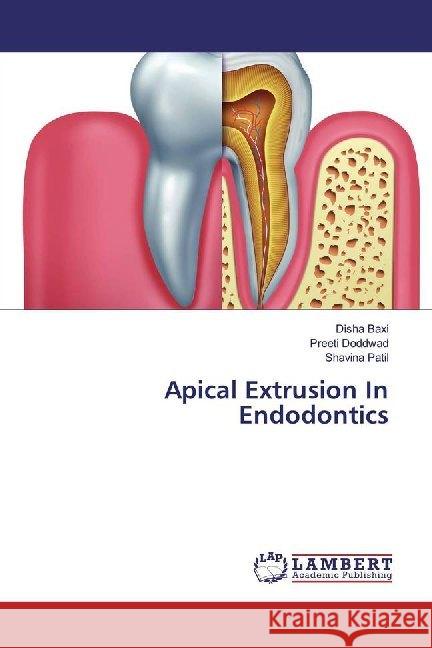 Apical Extrusion In Endodontics Baxi, Disha; Doddwad, Preeti; Patil, Shavina 9786139443000