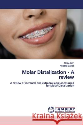 Molar Distalization - A review John, Rinju 9786139448876