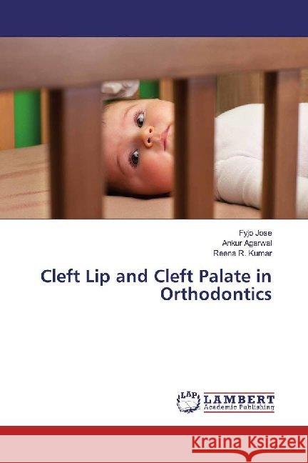 Cleft Lip and Cleft Palate in Orthodontics Jose, Fyjo; Agarwal, Ankur; Kumar, Reena R. 9786139449828 LAP Lambert Academic Publishing