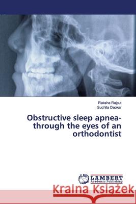 Obstructive sleep apnea- through the eyes of an orthodontist Rajput, Raksha; Daokar, Suchita 9786139452590 LAP Lambert Academic Publishing